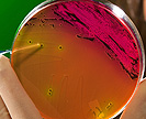 Salmonella colony on an agar plate