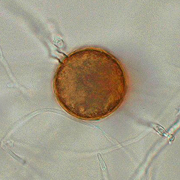 Microscopic image of a Phytophthora ramorum spore