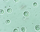 Yeast cells with large oil drops inside of them