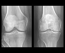 Knee x-rays.